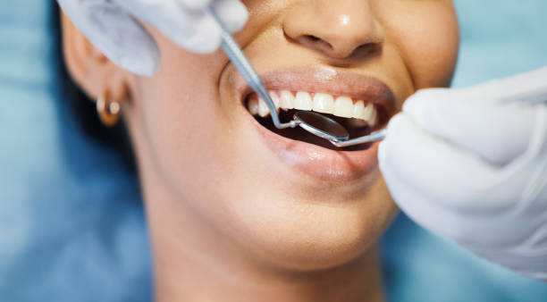 Best Emergency Wisdom Tooth Extraction in Sweetwater, TX